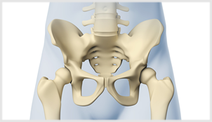 Imagem representativa para Osteoporose