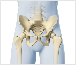 Imagem representativa de osteoporose